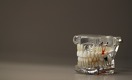 Золотые зубы: как повлияют на стоматологический рынок пенсионные деньги