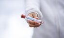 За сутки в Казахстане выявлено 403 заболевших коронавирусом: прирост 5,1%