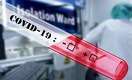 Как подготовка Африки к COVID-19 отразится на распространении вируса