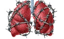 The Neglected Solution to the TB Crisis