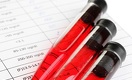 Four Ways to Beat HIV and AIDS
