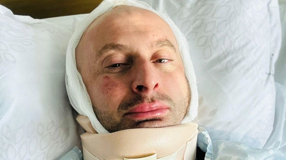 Гурам Рогава, журналист телекомпании «Формула», жестоко избитый полицией Гурам Рогава, журналист телекомпании «Формула», жестоко избитый полицией.